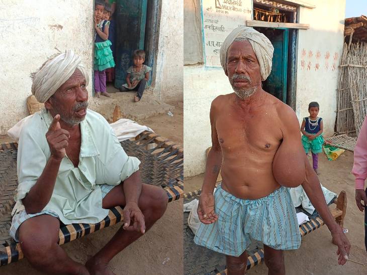 कालू को ऑपरेशन के बाद हाथ में ट्यूमर निकल आया। एक आंख की रोशनी भी चली गई।