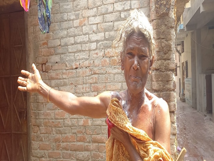 Edit attack victim narrated her ordeal | 'तीन कट्‌ठा जमीन और मकान हड़पने के  लिए रची पूरी साजिश, डायन बताकर मुझपर फेंका तेजाब' - Dainik Bhaskar