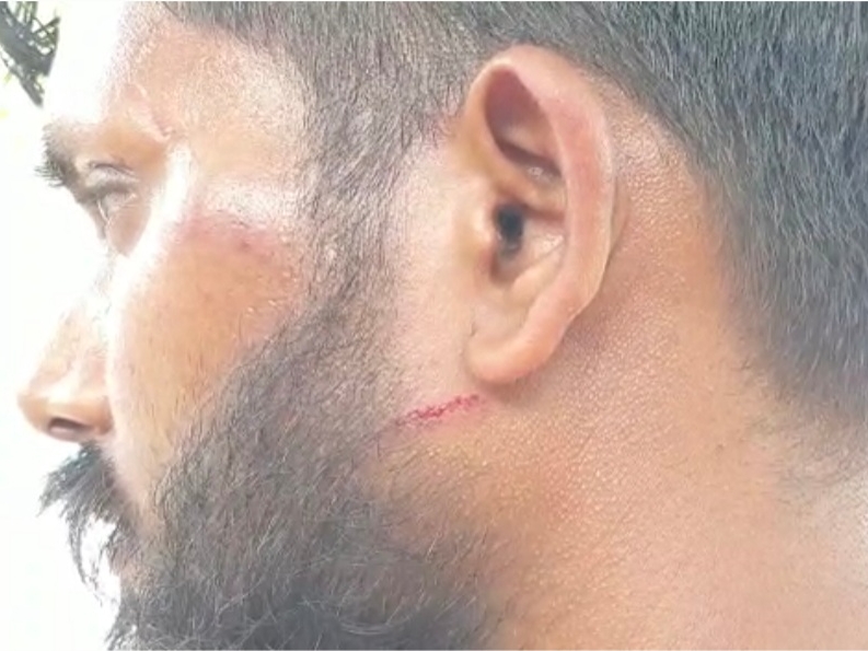 Scratches on face.