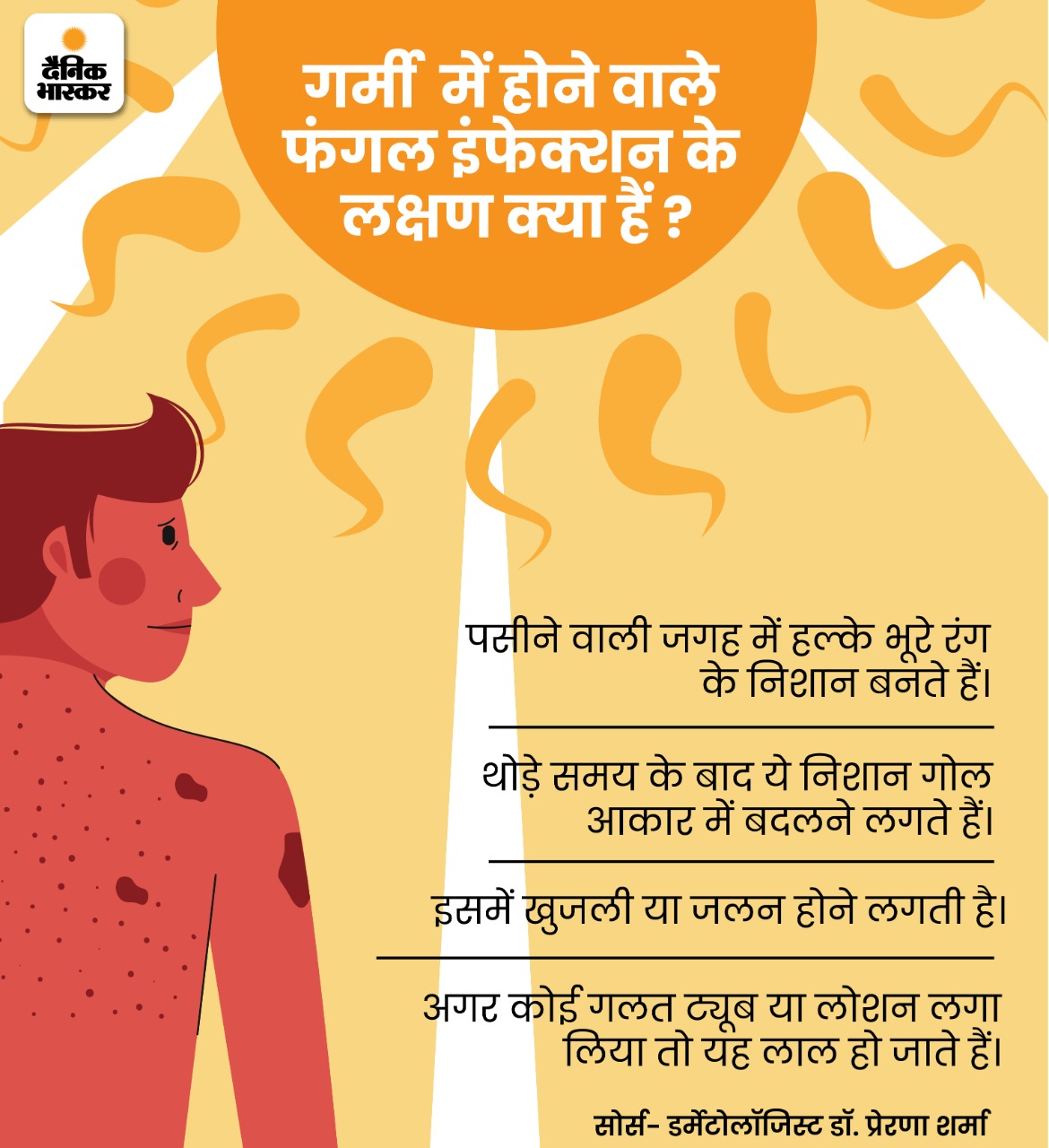 Why does itchy rash increase in summer? Before buying lotion, know its