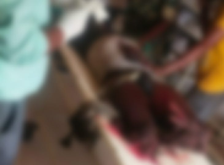 जवान के दोनों पैर के चिथड़े उड़ गए।