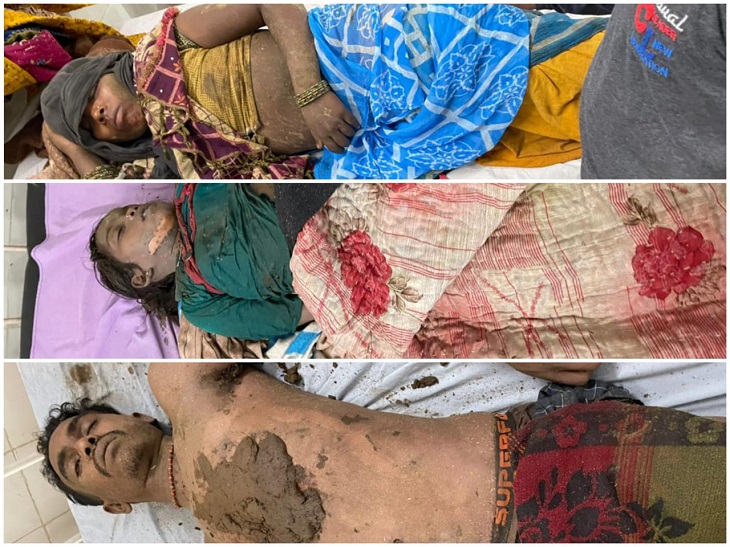 एंबुलेंस देर से पहुंची तो ग्रामीणों ने खुद ही गोबर लगाकर उपचार शुरू कर दिया। बाद में उन्हें अस्पताल में भर्ती कराया गया।