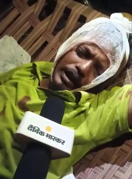 ये तस्वीर कानपुर के रिक्शा चालक मुकेश की है। हिंसा के दौरान सिर पर गहरी चोट आई है।