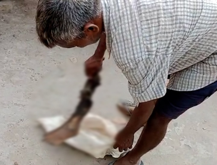 थैले में बेटी का पैर लेकर थाने पहुंचा पिता।