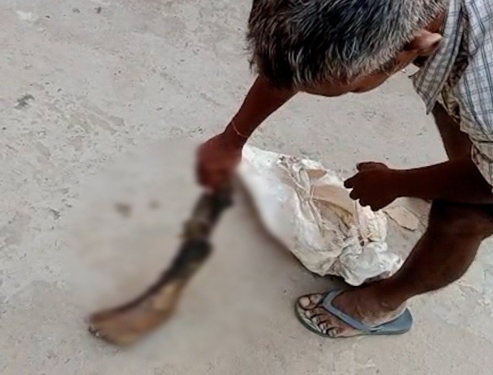 थाने के सामने बेटी का पैर दिखाता पिता।