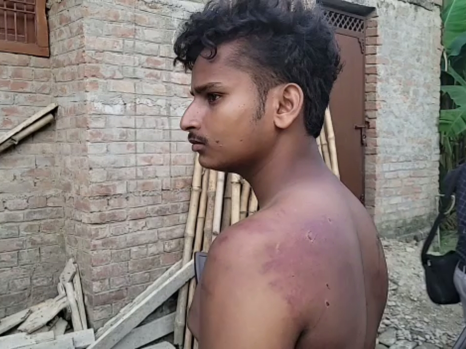 युवक के शरीर पर पीटने कारण बने निशान।