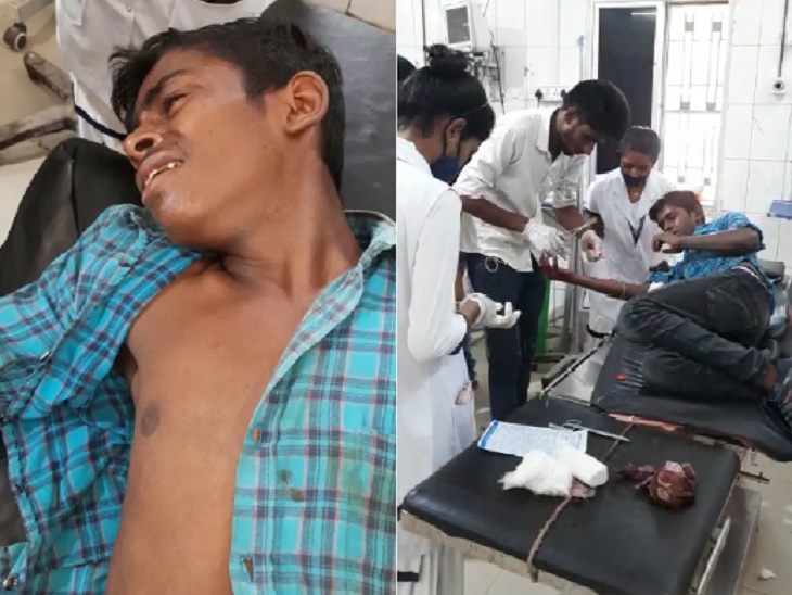 अमृत ने इलाज के दौरान कहा कि वो लड़की अब मेरे लिए मर चुकी है।
