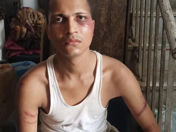 गिरफ्तार आरोपी बेटा। - Dainik Bhaskar