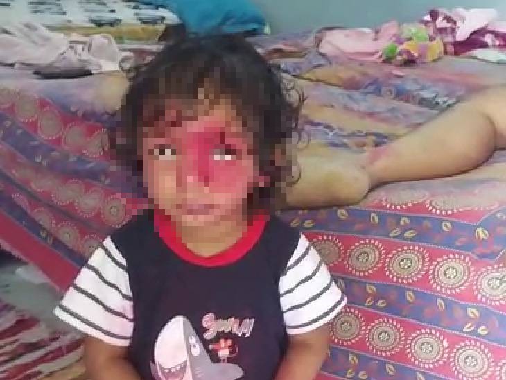 पिता के शव के साथ खेलते समय बच्ची के चेहरे पर भी सिंदूर लग गया।