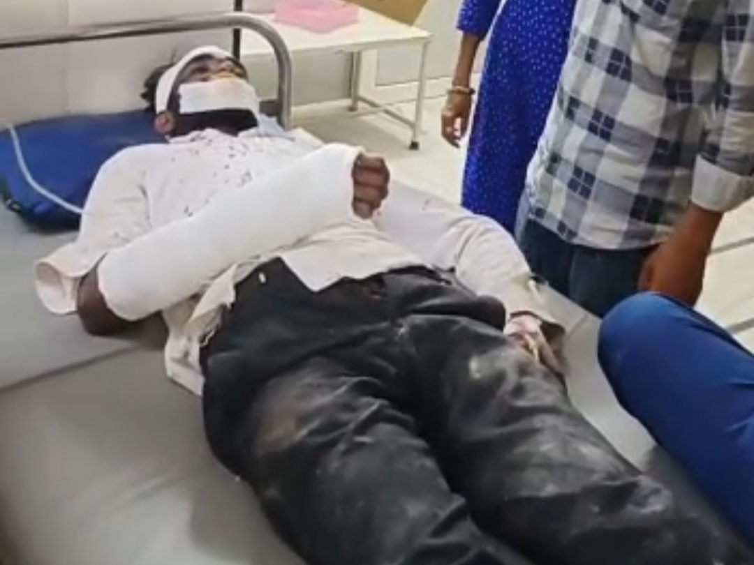 चूना भट्‌टा निर्माण के दौरान हादसा, ऊपर वाली अडाण टूटी तो नीचे दो अडाण