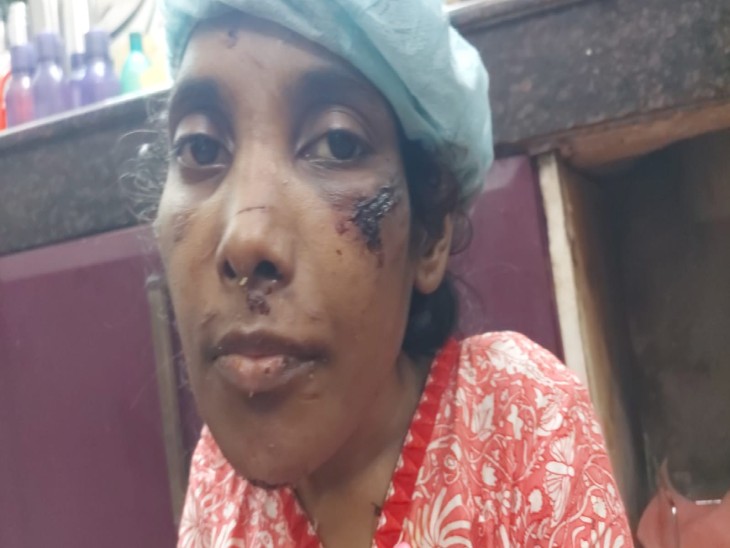 बंधक बनाई गई महिला के शरीर पर घाव के निशान मिले हैं। मेडिकली फिट होने के बाद पुलिस उसका बयान दर्ज करेगी। उसकी सुरक्षा में दो पुलिकर्मियों को भी लगाया गया है।