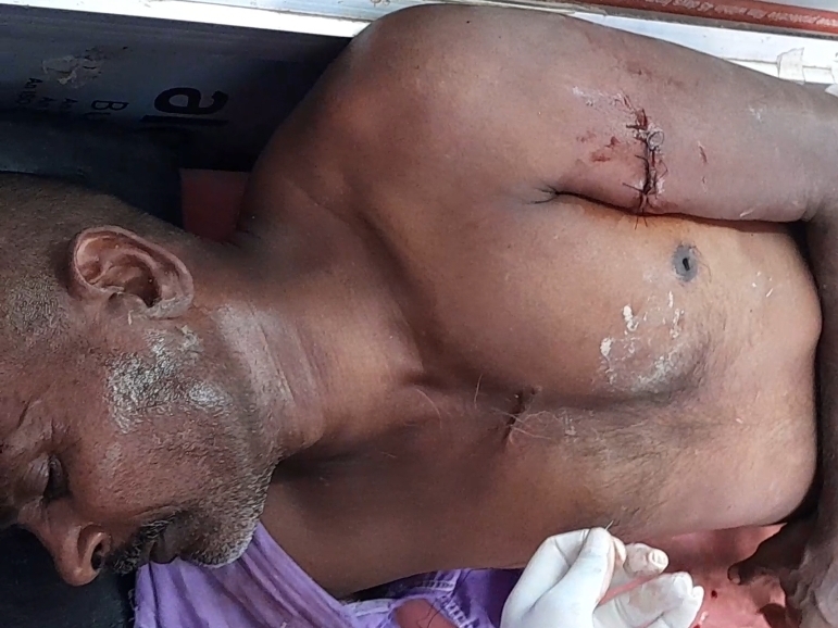 सीवान में ब्लैक कोबरा के डसने से महिला की मौत: रात में सोने के दौरान पेट पर  सांप ने डसा, इलाज के दौरान तोड़ा दम – Bharat News India