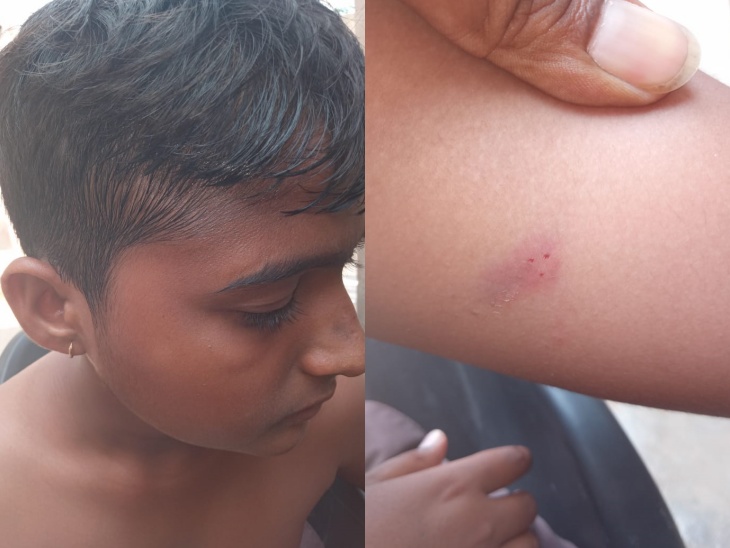होमवर्क नहीं किया तो साइंस टीचर ने मारे 15 थप्पड़: हाथ पर चूंटियां काटीं बेहोश होकर गिरा हॉस्पिटल में एडमिट होमवर्क नहीं किया तो साइंस टीचर ने मारे 15 थप्पड़: हाथ पर चूंटियां काटीं बेहोश होकर गिरा हॉस्पिटल में एडमिट