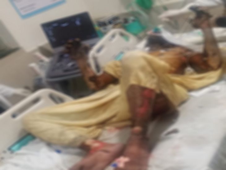 प्रारंभिक जांच में सामने आया है कि टैंकर के ऊपर ईंधन भरने के लिए बने ढक्कन के पास टैंकर का कुछ हिस्सा फटा है, जिससे ब्लास्ट हुआ।