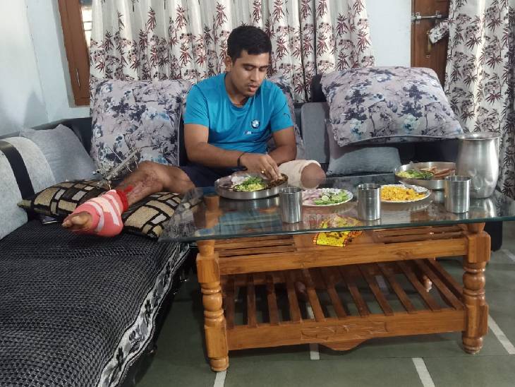 ये हैं लांस नायक अचल पटवारी। इनके दाएं पैर को जूम इन करके देखिए। आतंकियों की 3 गोलियां लगने के बाद भी सेना में वापस जाने का जज्बा बरकरार है।