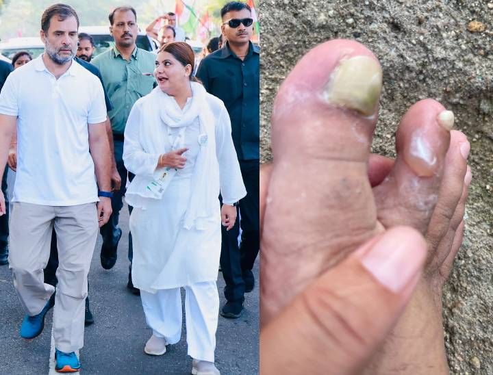 भारत जोड़ो यात्रा के दौरान राहुल गांधी के साथ नूरी खान। नूरी के पैर में छाले पड़ गए। उन्होंने कहा- राहुल गांधी के चेहरे पर जो सौम्यता थी, वो अब संत के भाव के साथ उनके चेहरे पर आत्मविश्वास के रूप में झलकती है।