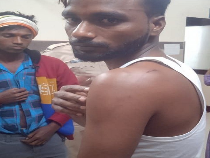 थाने पहुंचा पीड़ित पक्ष अपनी चोट को दिखाते हुए