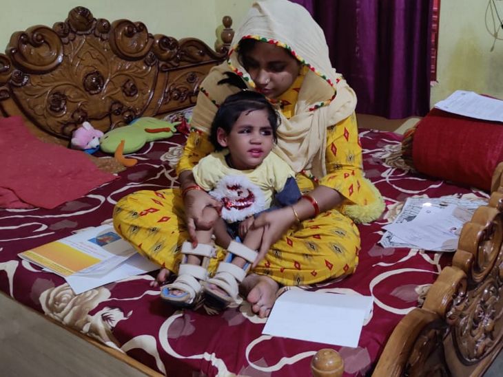 मां शायना का कहना है कि बेटी के पैर टेढ़े हो चुके हैं। पैर में बेल्ट बांधना पड़ता है। वह दुबली हो चुकी है, जिससे पसलियां उभरकर दिखने लगी हैं।