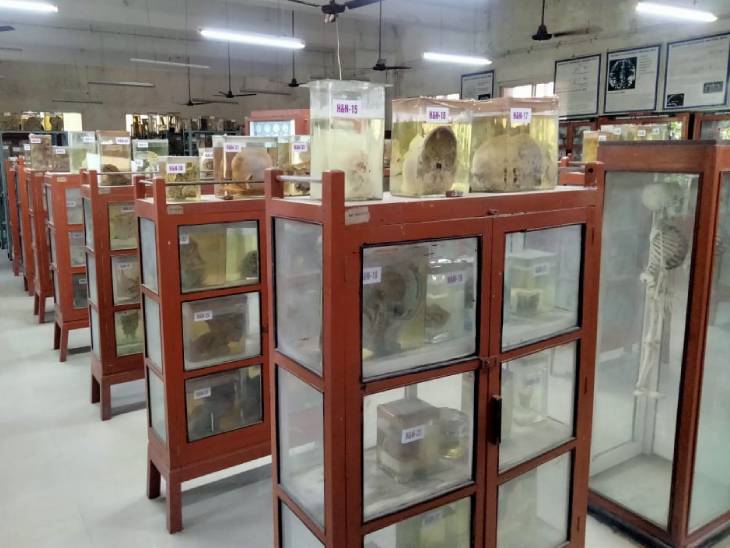 इस तरह अलमारी में कांच के अलग-अलग जार में केमिकल में डुबोकर शरीर के अंगों को रखा जाता है। इंदौर के MGM कॉलेज के एनाटॉमी डिपार्टमेंट के म्यूजियम में बॉडी का हर पार्ट रखा हुआ है।