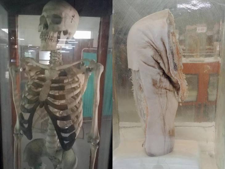 म्यूजियम में स्पेसिमेन के अलावा स्केलेटन भी रखे गए हैं। बॉडी के अलग-अलग पार्ट्स की हड्डियों के बारे में भी मेडिकल स्टूडेंट्स को बताया जाता है।