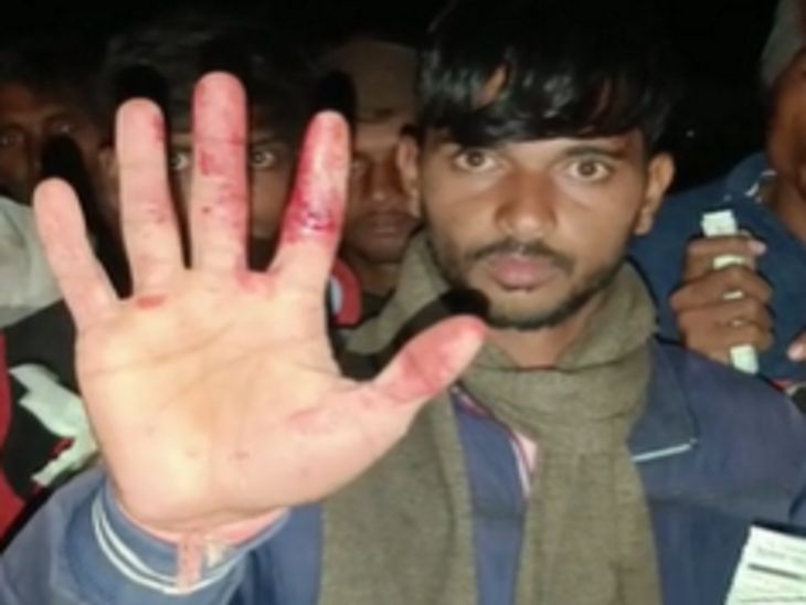 युवा किसान रामबाबू सोंधिया के हाथ में कांच लग गया, जिससे वह लहूलुहान हो गया।