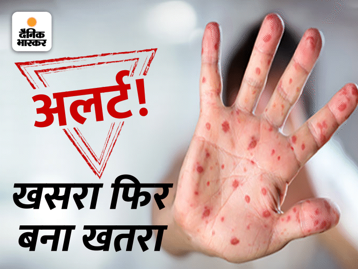 measles-more-dangerous-than-ebola-causing-death