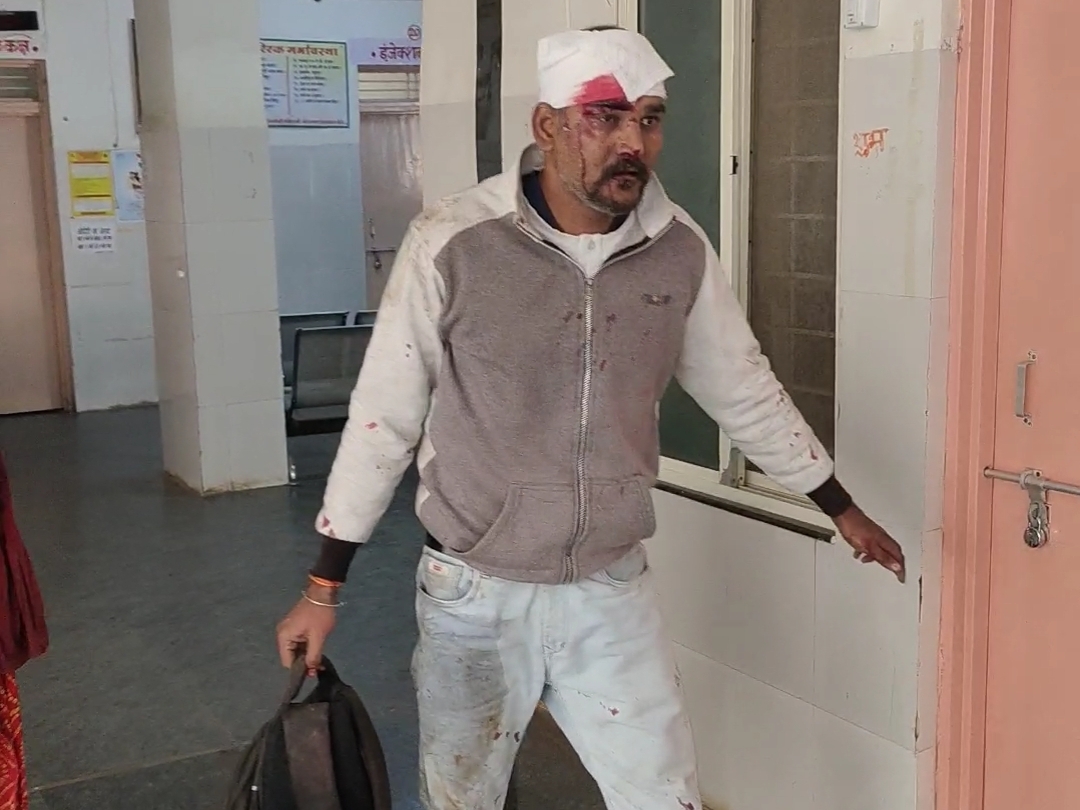 हादसे में 47 लोग घायल हुए हैं। सभी को बड़वाह के सिविल अस्पताल में भर्ती कराया गया।