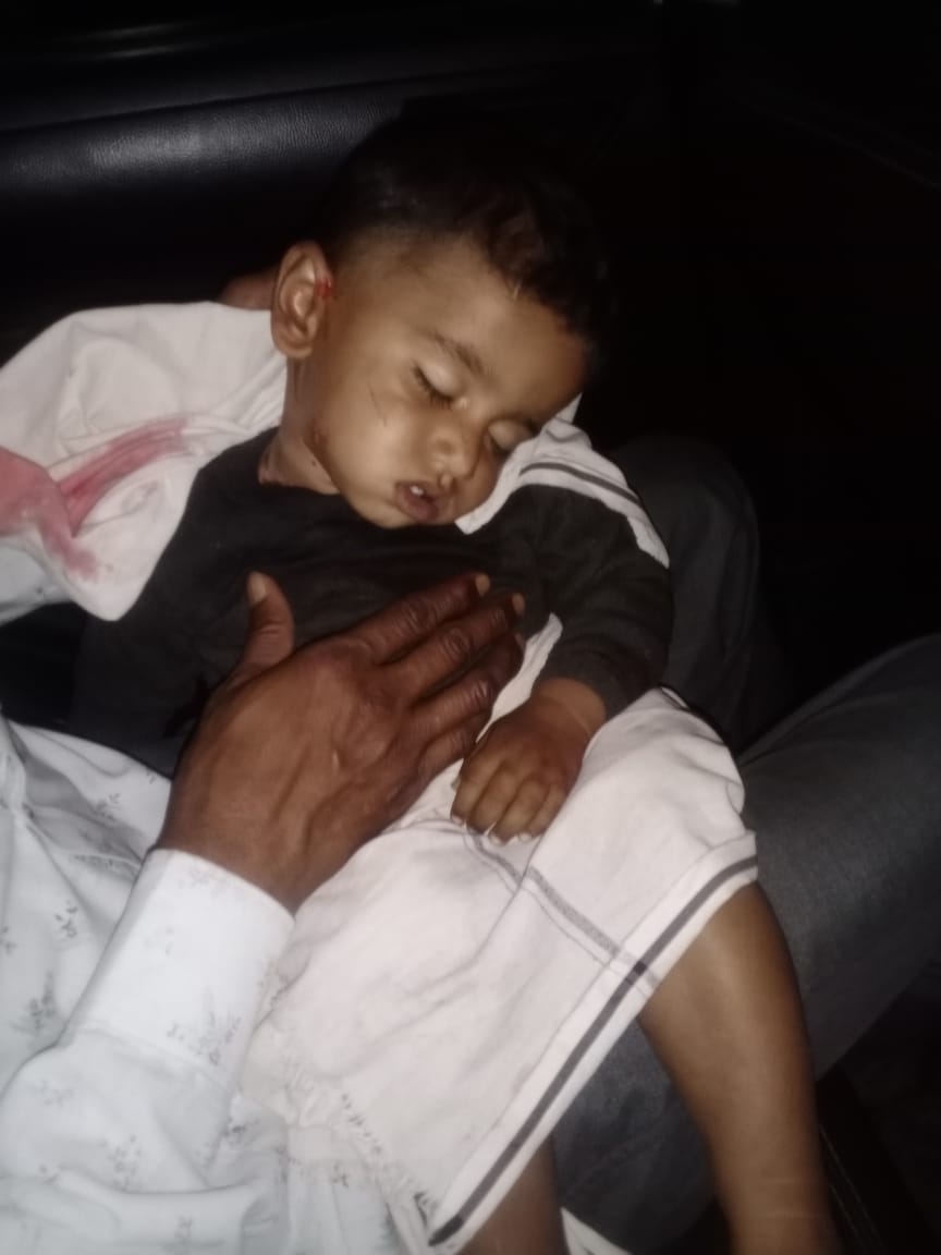 हमले के दौरान घर में मां-बेटे के अलावा कोई नहीं था। लोगों ने बताया कि वे डंडे लेकर लेपर्ड के पीछे भागे थे, लेकिन वह तेजी से जंगल की ओर भाग गयया।