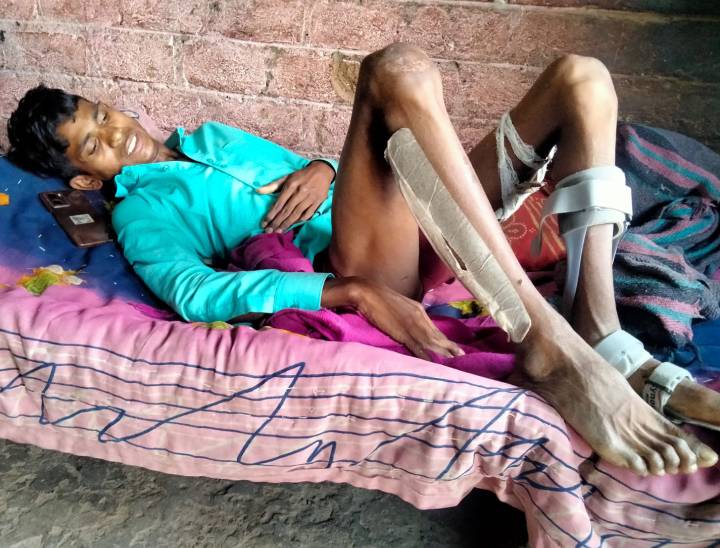 पैर में गोली लगने के बाद से एमवाय अस्पताल में भर्ती संजय कटारे शनिवार शाम को अस्पताल से डिस्चार्ज होकर गवली पलासिया स्थित अपने घर पहुंचा।