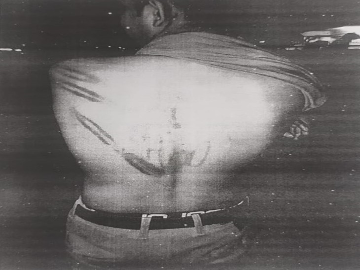 मैनेजर की पीठ पर टॉर्चर के निशान - Dainik Bhaskar