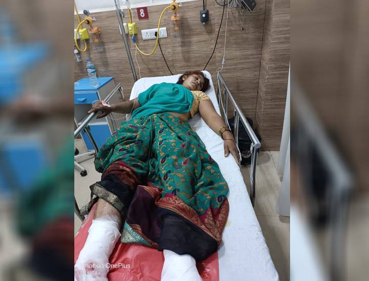 हादसे में घायल महिला का अरविंदो अस्पताल में इलाज जारी है। इनका नाम शारदा दिनेश उम्र 40 साल निवासी कावेरी नगर बताया गया है। शारदा के दो बेटों की इस हादसे में मौत हो गई है।