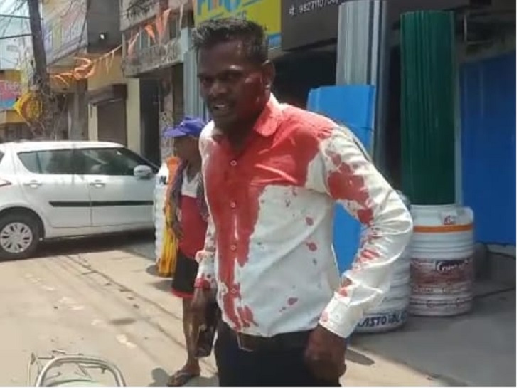 दो बदमाशों ने मिलकर चाकू से किया हमला।