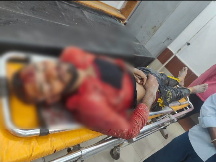 गंभीर रूप से घायल युवक ने अस्पताल पहुंचने से पहले ही तोड़ा दम।