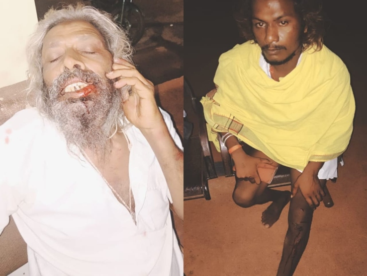 घायल पुजारी औरउनका संत साथी, बेहट थाना में बैठे हुए - Dainik Bhaskar