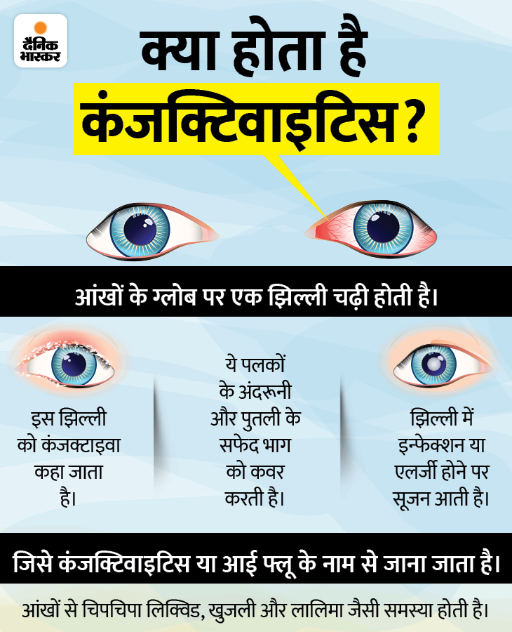 Pathankot People Suffering From Eye Conjunctivitis Disease Viral