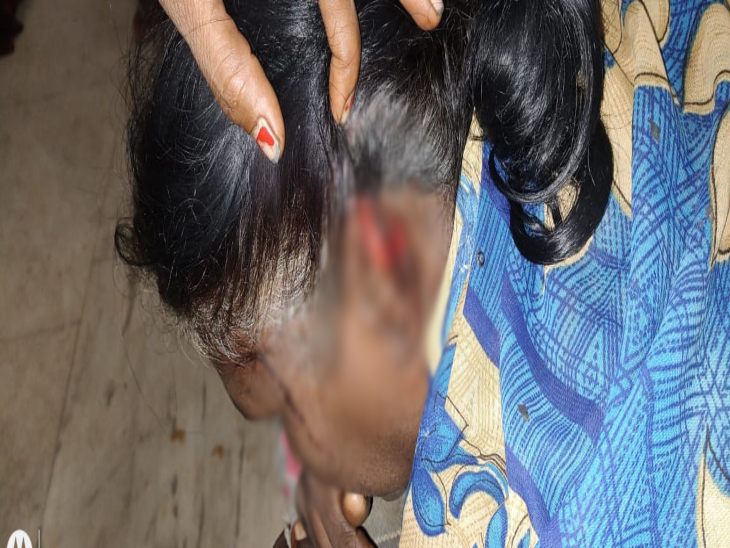 भालू के हमले में घायल हुई महिला का इलाज अस्पताल में चल रहा है।