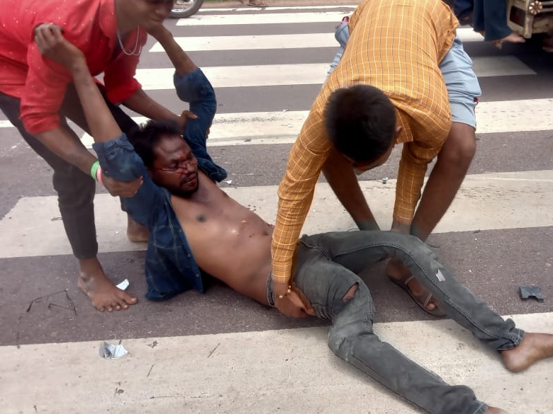 सड़क हादसे में 4 लोग घायल हो गए। एक युवक के पैर की हड्डी टूट गई है।