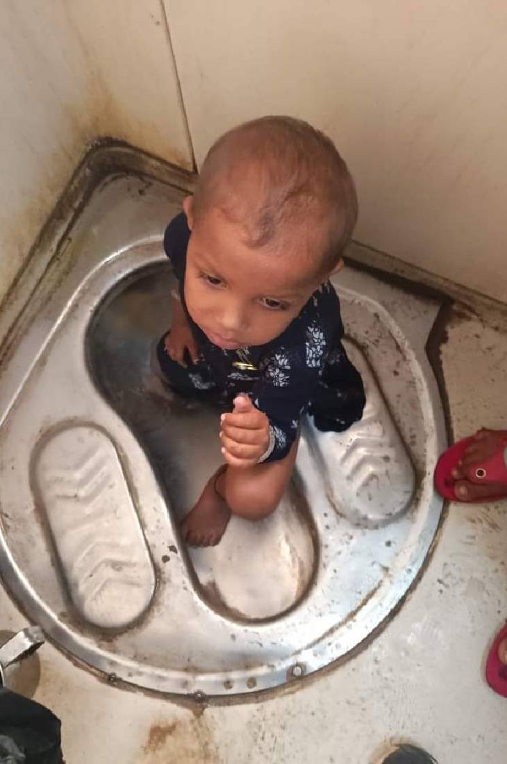 The girl's leg got stuck in the commode in the moving train, the train