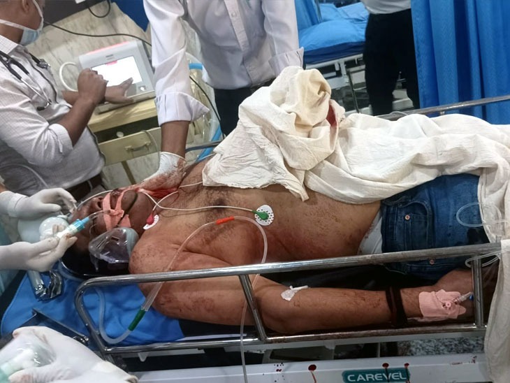नीलेश मुखिया को बदमाशों ने 8 गोलियां मारी थीं।