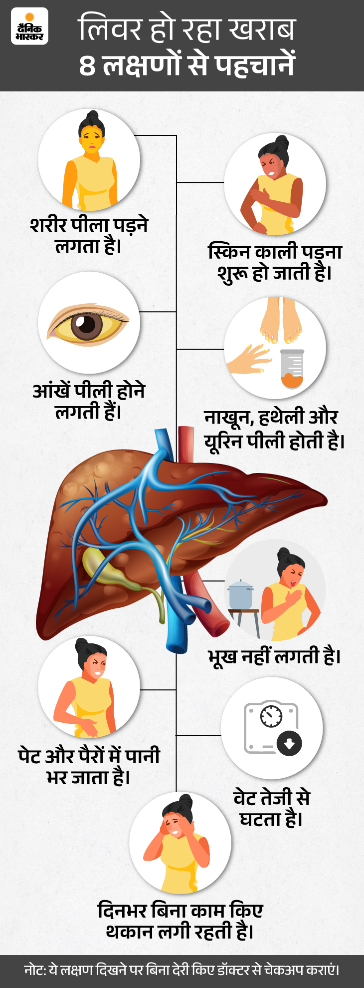 Black Jaundice Symptoms Kya Hai Explained; Kala Piliya Kya Hota Hai
