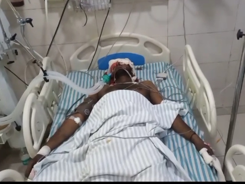 Artisan injured due to explosion of grinder for making scissors in