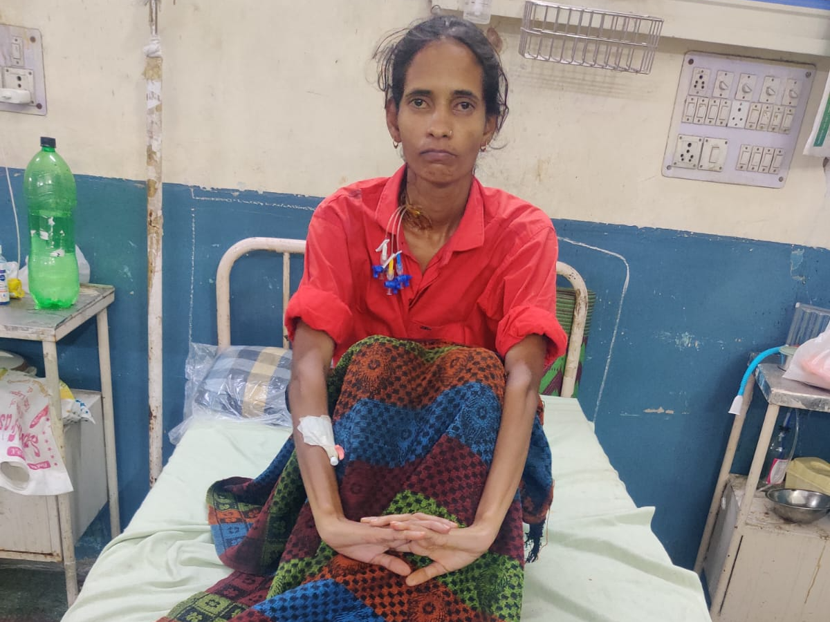 Nutcracker Syndrome Surgery Success at Jaipur SMS Hospital SMS में नट