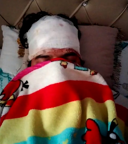 पीड़िता मिंटू कंवर के सिर में गहरी चोट लगी।