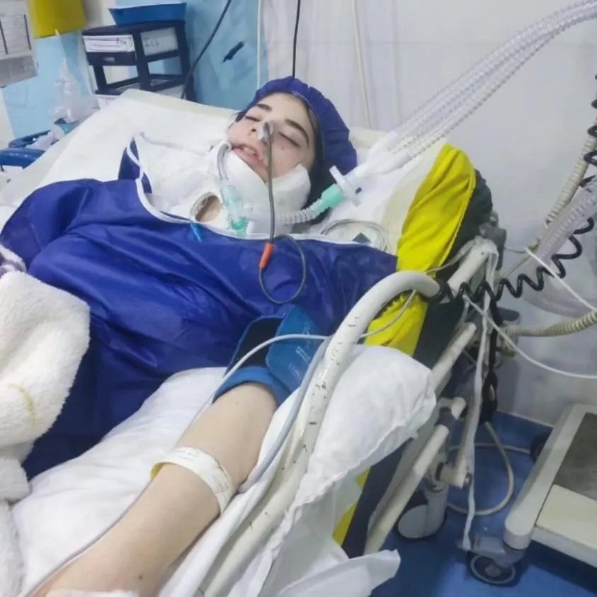 Accusation on Iranian police - Teenager in coma after beating