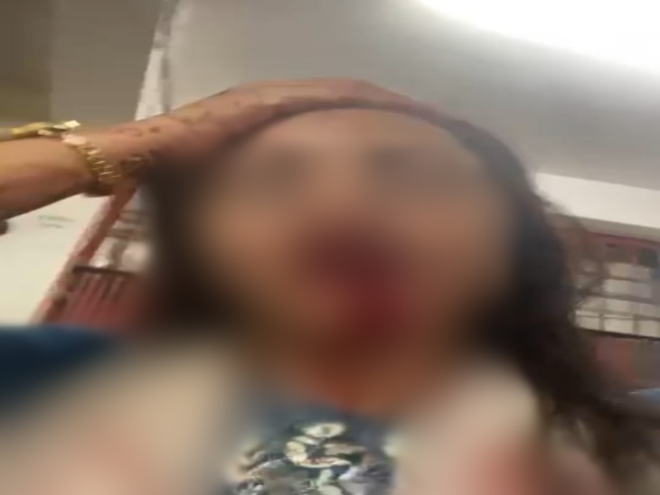इसमें एक युवती बुरी तरह लहूलुहान हो गई।