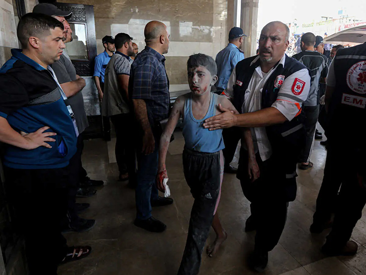 इजराइली बमबारी में घायल एक बच्चे को अस्पताल लाया जा रहा है।