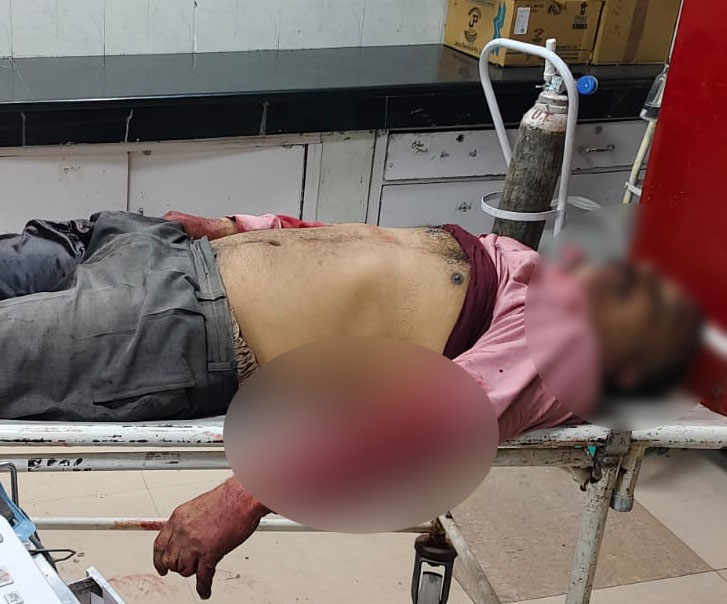 शरीर पर करीब आधा दर्जन तेजधार हथियार के निशान मिले हैं। पुलिस ने शव को कब्जे में लेकर आगामी कार्रवाई शुरू कर दी है।