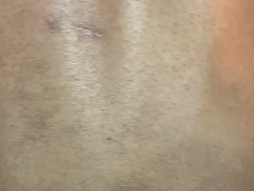 3-4 महीने से स्मैक का नशा करने का आदी हो गया था, जिसके बाद परिजनों ने युवक को नशा मुक्ति केंद्र में छोड़ दिया था।