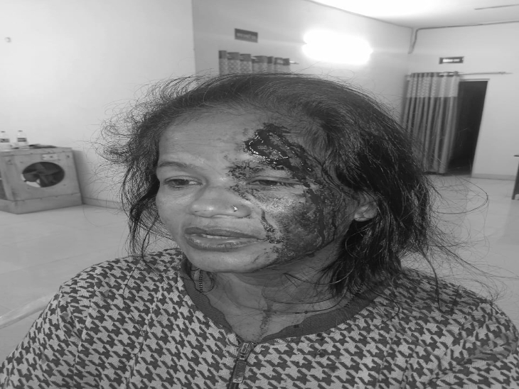 मारपीट में घायल हुई महिला।