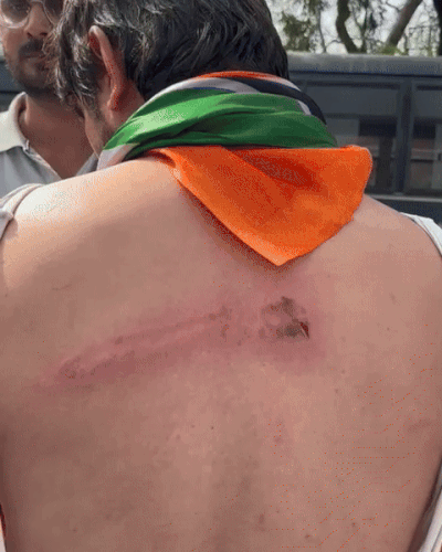 पुलिस के लाठीचार्ज में यूथ कांग्रेस के प्रदेश सचिव जयदत्त जांगिड़ समेत कई लोगों के चोटें आई हैं।